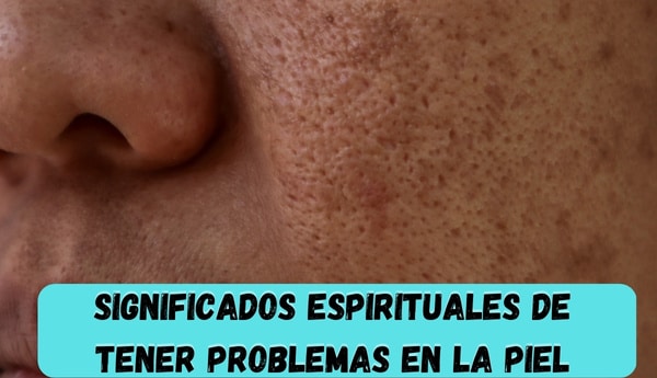 La sorprendente conexión entre la urticaria y su significado espiritual